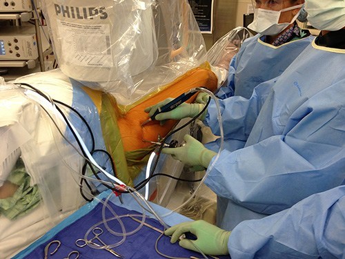 Hip Arthroscopy