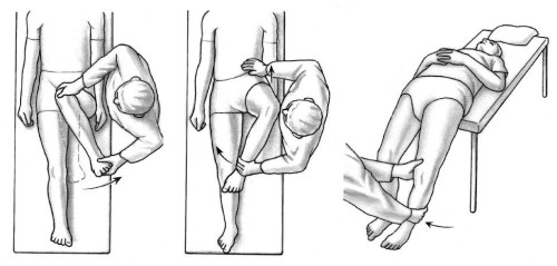 Labral Tear