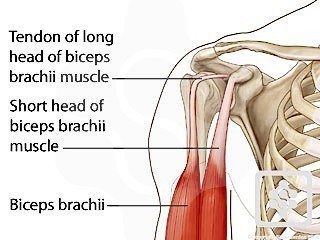 Rotator Cuff Repair